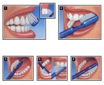 οδοντούβουρτσα, ηλεκτρική οδοντόβουρτσα, χειροκίνητη οδοντόβουρτσα, καθαρισμός οδοντιών, στοματική υγιεινή, οδοντόκρεμα, βούρτσιμα, σωστό βούρτσισμα,  odontovourtsa, vourtsisma, swsto vourtsisma, ilektriki odontovourtsa, xeirokiniti odontovourtsa, katharismos dontiwn,  stomatiki ugieini, Τσαλιγοπούλου Ευθυμία, Λαγκαδά 130, Τηλέφωνο 2310 822572, οδοντίατρος, οδοντιατρικές υπηρεσίες, δόντια, υγεία στόματος, οδοντιατρική υγεία,  οδοντιατρείο, odontiatros, odontiatrikes upiresies, dontia, odontiatreio, odontiatriki ygeia, ygeia stomatos 